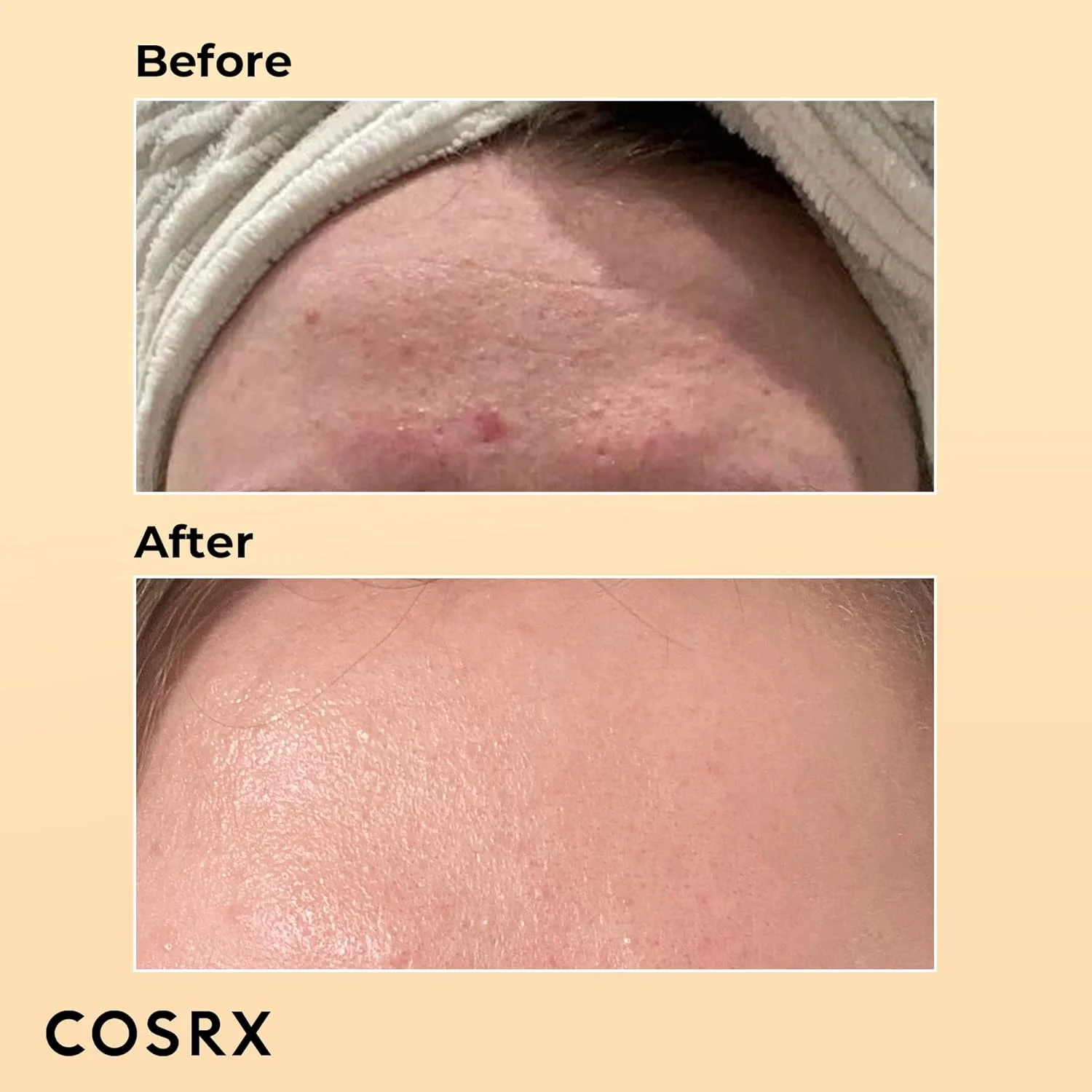 COSRX Snail Mucin 96% Power Repairing Essence 100ml, Hydrating Serum for Face with Snail Secretion Filtrate for Dull Skin & Fine Lines, Korean Skincare